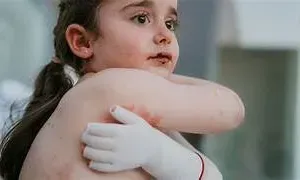 Canguro en Castellón a nivel profesional