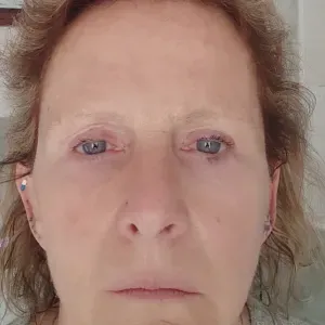 Garde chien dieppe et environs 