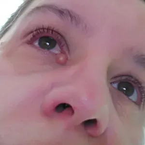 petsister nancy sur le plateau de malzeville 